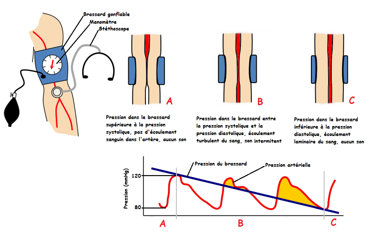 Biologie Simplifiée - La pression artérielle ou tension artérielle : c'est  la pression qui règne à l'intérieur des artères. La mise en tension des  parois artérielles permet au sang de circuler correctement