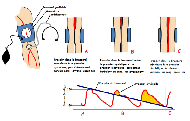 Schéma représentant le principe de mesure de la pression artérielle par sphygmomanométrie